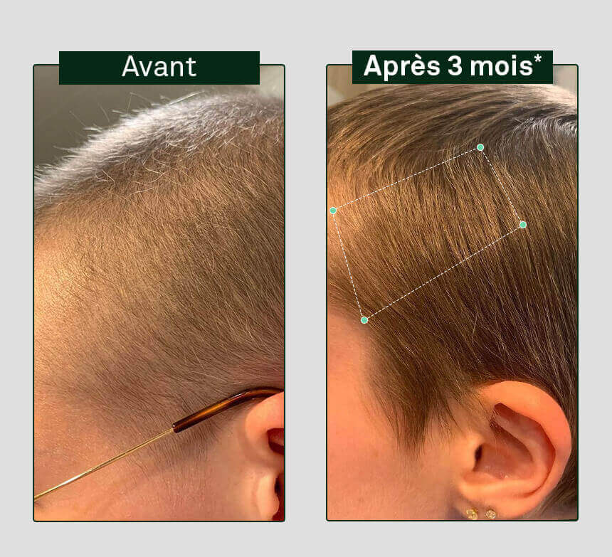 علكات-قوة-نمو-صمغ-قوة-نمو